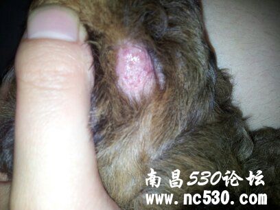 急急！大家帮忙看看这是什么皮肤病？图片两张