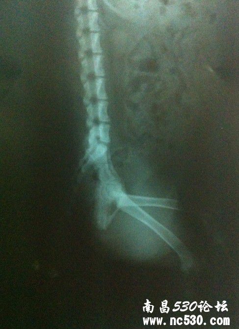 是不是CHD病，附上X光片。