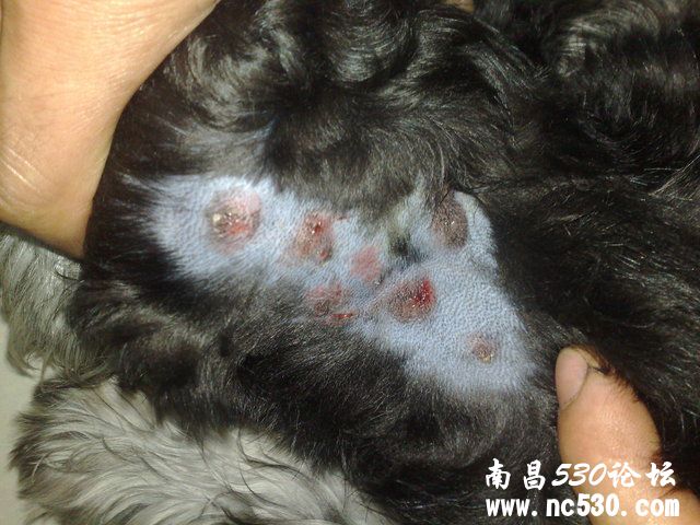 请大家帮忙看看是什么皮肤病！急！