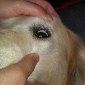 左眼皮长了个疙瘩，怎么办？